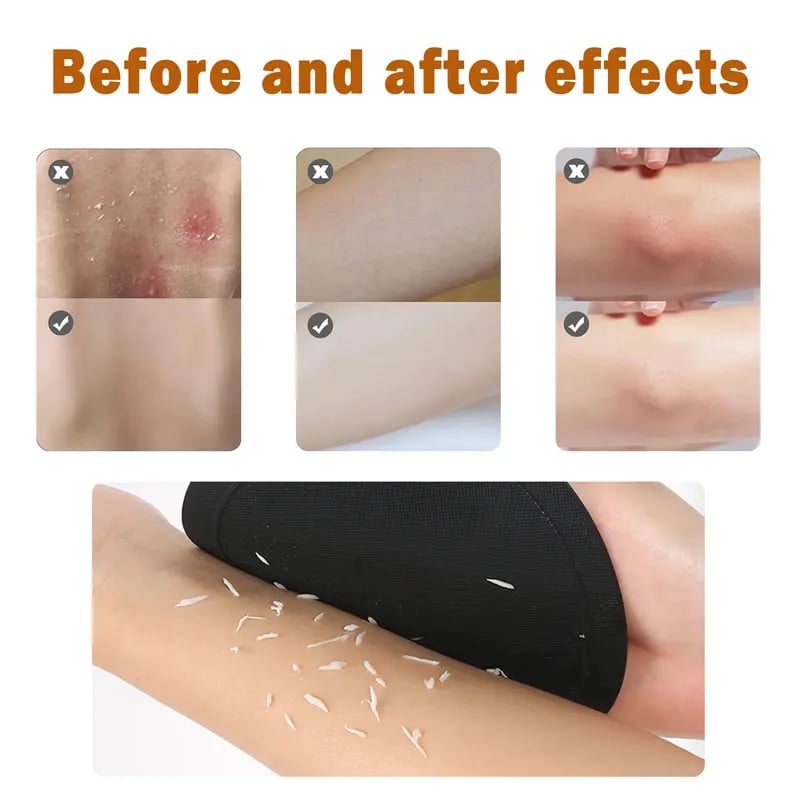 🧽 4-Pack Soft Rubber Shower Scrubber – Gentle Yet Effective, Exfoliates & Cleanses All Skin Types